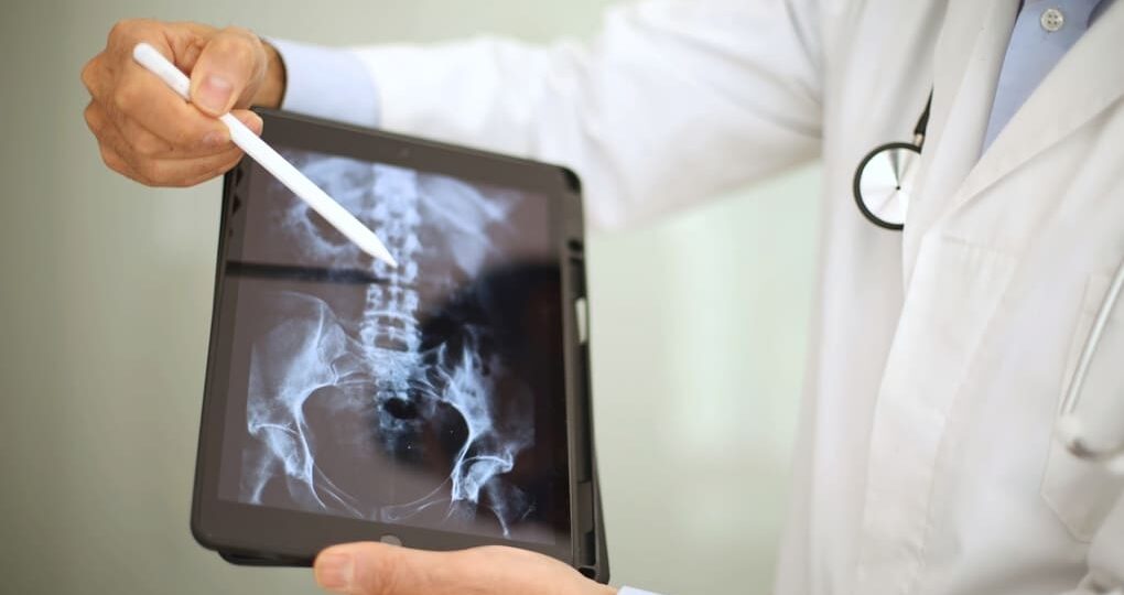 Terapias especializadas para la distrofia muscular en Panamá