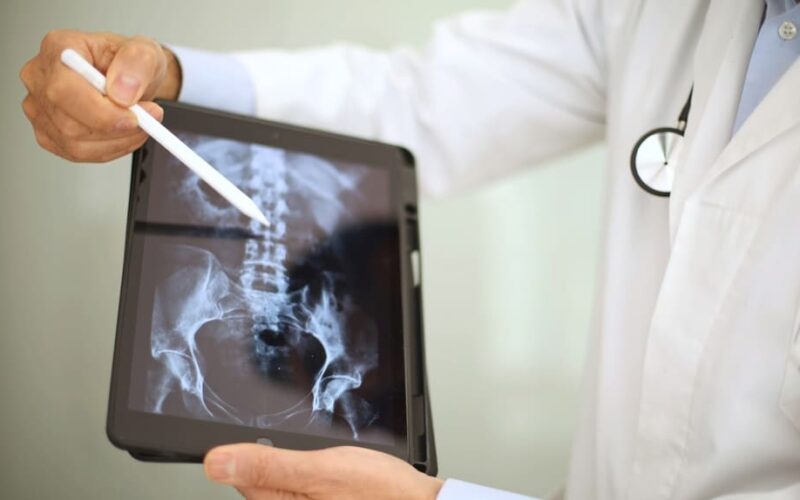 Terapias especializadas para la distrofia muscular en Panamá